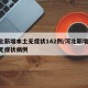 河北新增本土无症状142例/河北新增14例无症状病例